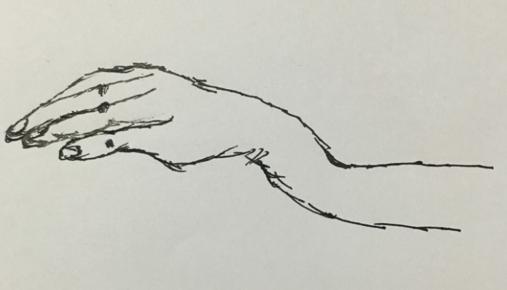 护理学基础知识:考点记忆梳理常见的四肢骨骨折